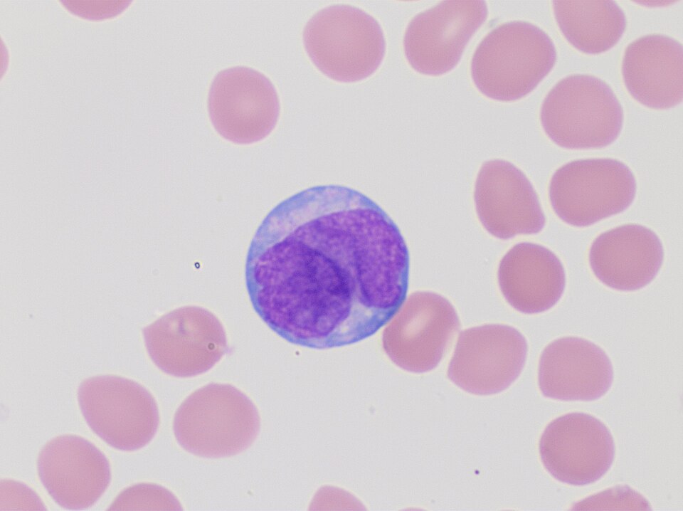 Leukemia care and blood testing visual