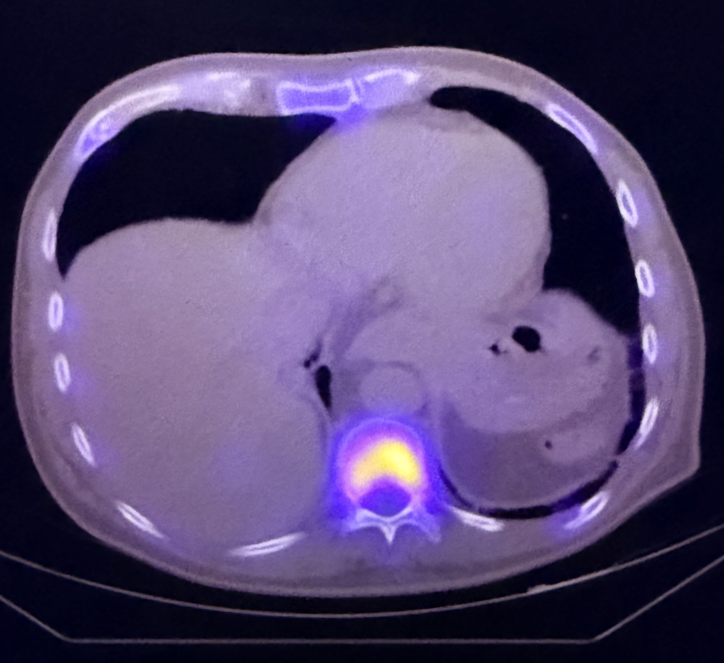 PET-CT scanner example