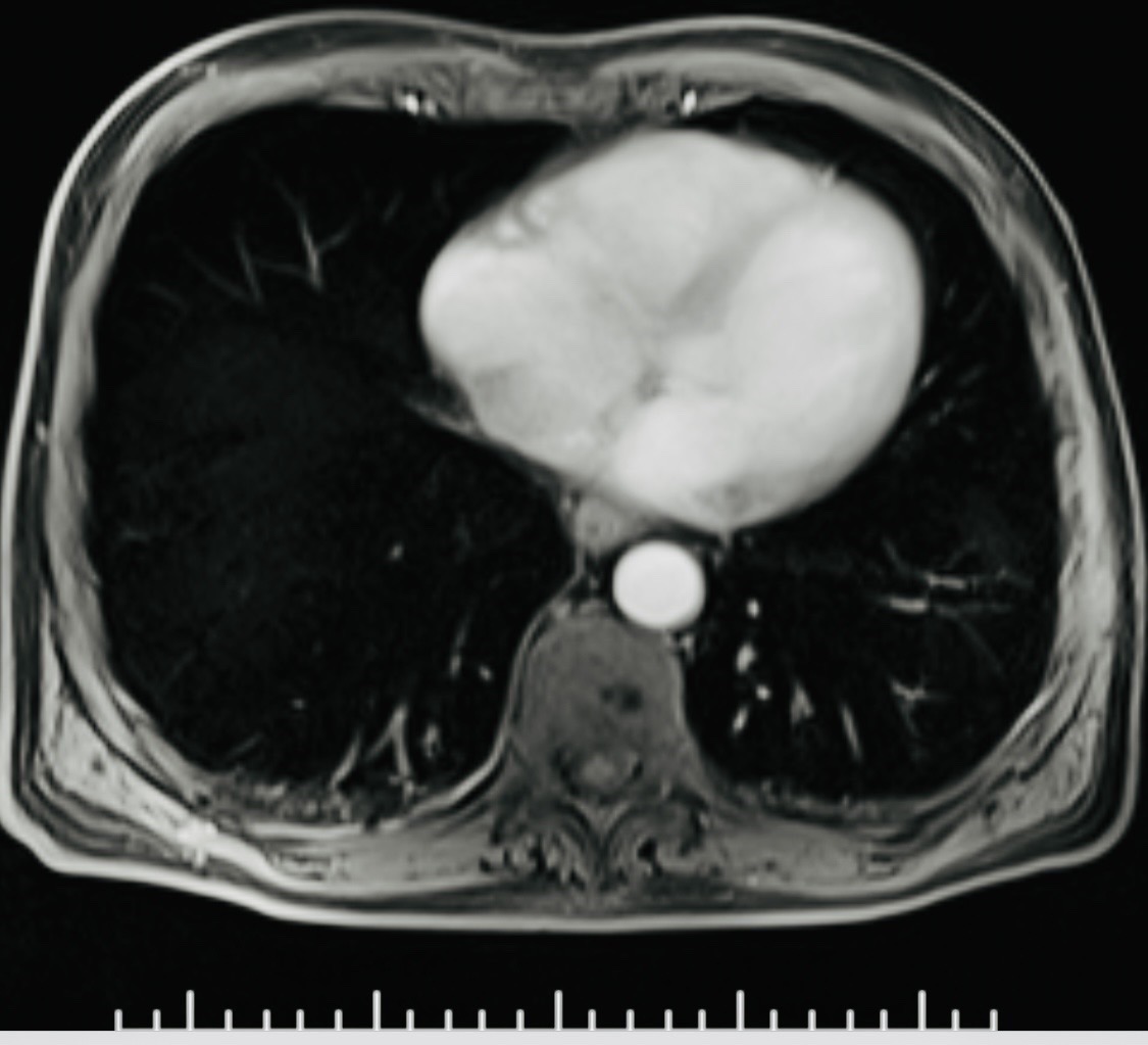 Chest imaging example