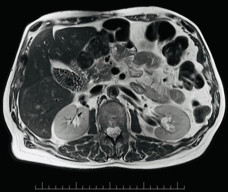 Abdominal MRI example.